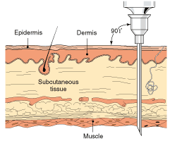 muscle injection